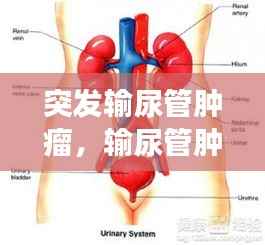 突发输尿管肿瘤,输尿管肿瘤发展快吗