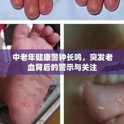 中老年健康警钟长鸣,突发老血背后的警示与关注